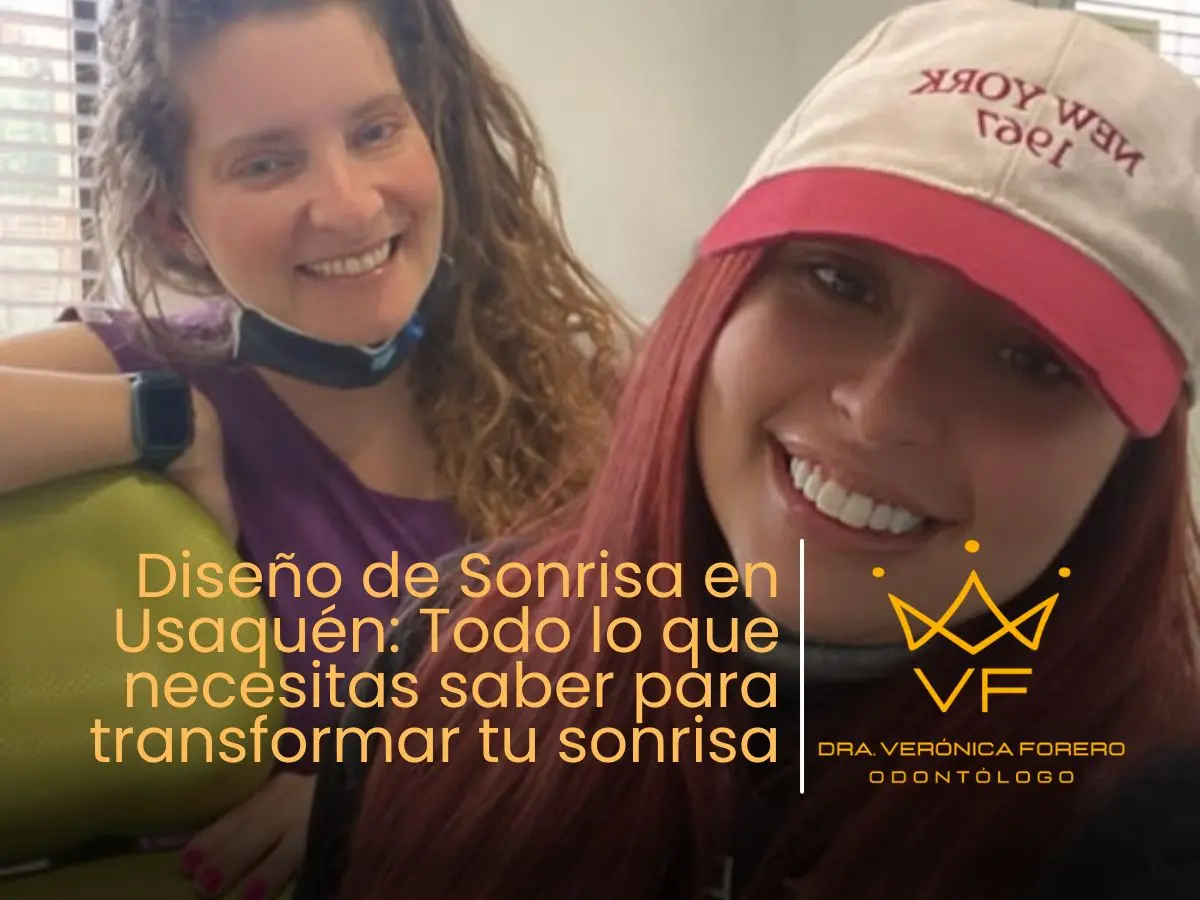 Diseño de sonrisa en Usaquén Todo lo que necesitas saber para transformar tu sonrisa.