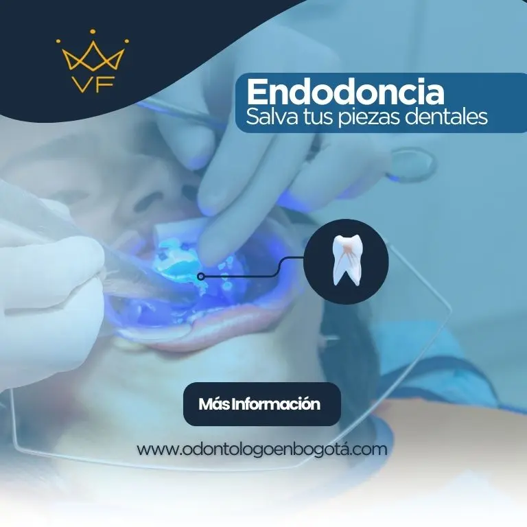 Endodoncia