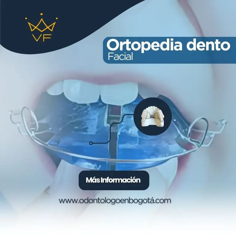 Ortodoncia dento facial