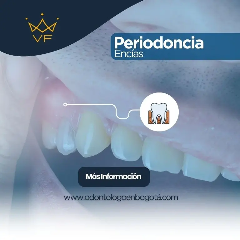 Periodoncia